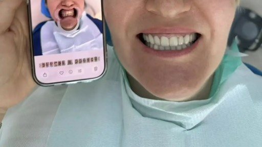 Пациентка клиники Ченгши после лечения — новая улыбка